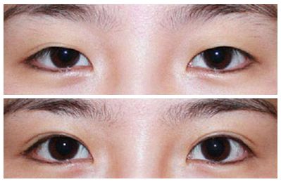 南京哪所整容醫(yī)院的面部脂肪雕刻效果比較好？2023南京面部脂肪雕刻院根據(jù)排名，這些醫(yī)院TOP10榜單值得關注