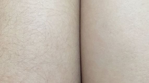 沈陽去黑斑好的醫(yī)院排名及專家推薦