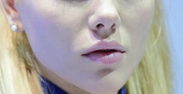 2023年哈爾濱眼部整形醫(yī)院排名公布！治療眼睛細(xì)紋好的小切口醫(yī)院TOP10