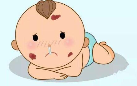 假體隆胸術(shù)后如何正確哺乳？隆胸是否會(huì)對(duì)哺乳產(chǎn)生影響？