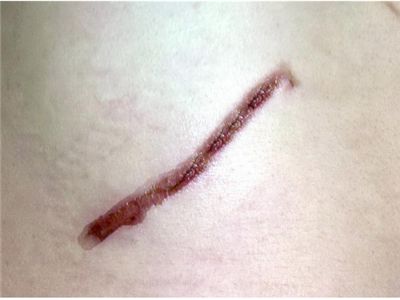 TFBOYS整容了嗎？探秘娛樂圈流行整容趨勢