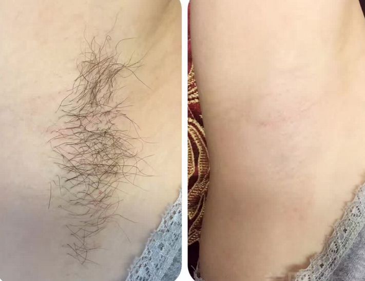 沈陽哪家醫(yī)院去眼袋做的好？頂級(jí)專家?guī)湍憬獯穑?></div>
                            <div   id=