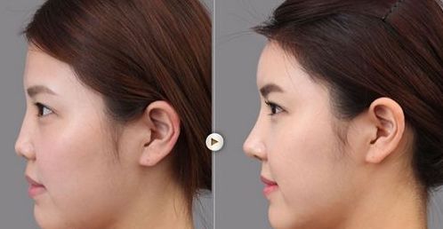 太原好的美容醫(yī)院是哪家？國內(nèi)口碑最佳的太原美容醫(yī)院排行榜一覽