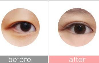 優(yōu)質(zhì)的南昌光子嫩膚整形醫(yī)院推薦！選擇佳美、韓美等可信賴！2023最新資訊！