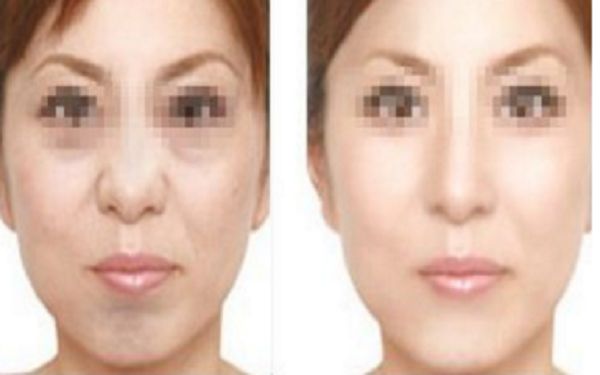 黑龍江口碑好的胎記祛除醫(yī)院盤點：詳細對比