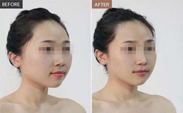 東莞納晶祛痘專家推薦，排名前10的醫(yī)院分享