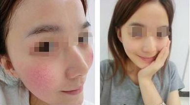 2024年紹興雙眼皮醫(yī)院排行榜出爐！年度10家醫(yī)院大揭秘！