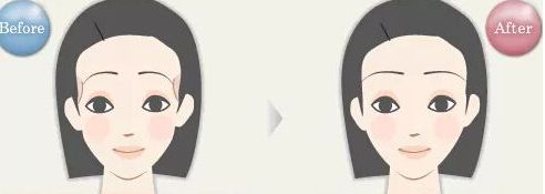 常德微針嫩膚口碑榜前十：提升美肌，見證奇跡