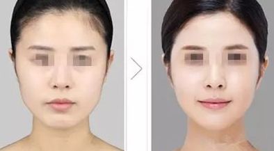 深圳拔罐刮痧整骨醫(yī)院口碑排行榜