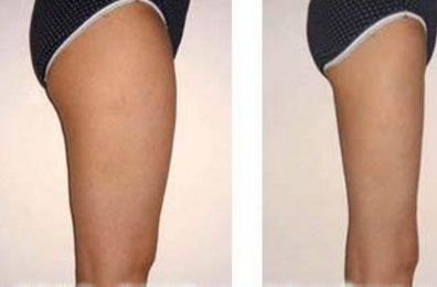 邢臺(tái)人民醫(yī)院整形科主任張俊斌，專(zhuān)業(yè)鼻部整形術(shù)讓你美麗動(dòng)人