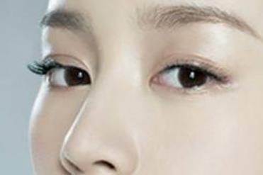 隆鼻效果能保持多久？何種因素會影響持久性？