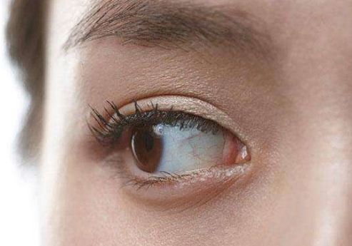 2023年中山高口碑手術(shù)去除眼紋整形醫(yī)院排行榜，榜單揭秘！