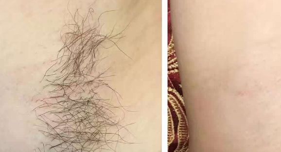 連云港激光醫(yī)院排名前三，哪家好？