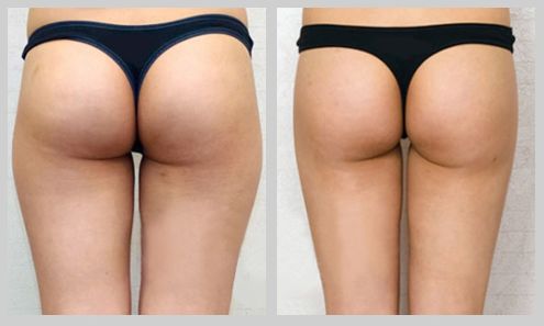 云南做熱瑪吉整形醫(yī)院哪家好，專(zhuān)家推薦的熱瑪吉美容醫(yī)院Top選擇