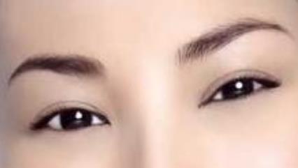 激光祛斑后怎么避免皮膚反黑現(xiàn)象？