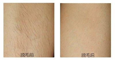 饒陽(yáng)縣醫(yī)院是醫(yī)美整形的首選饒陽(yáng)縣醫(yī)院會(huì)給你帶來(lái)滿意的效果嗎