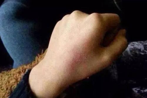 北京青春痘醫(yī)療美容醫(yī)院2023年評(píng)分前10名公私對(duì)比！尋找值得去的復(fù)合彩光治療醫(yī)院