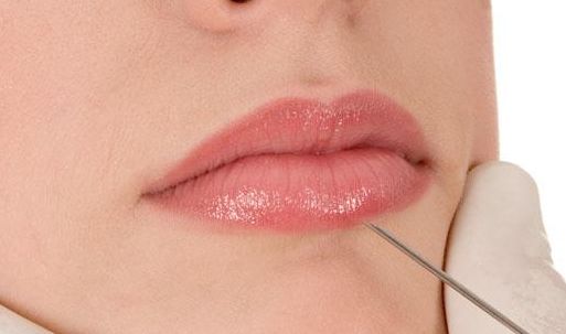 江蘇哪家雙眼皮醫(yī)院好？專家推薦江蘇雙眼皮醫(yī)院排行榜