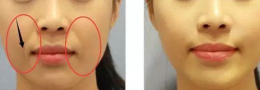 唐山值得推薦的美容整形醫(yī)院，公立數(shù)量居多！