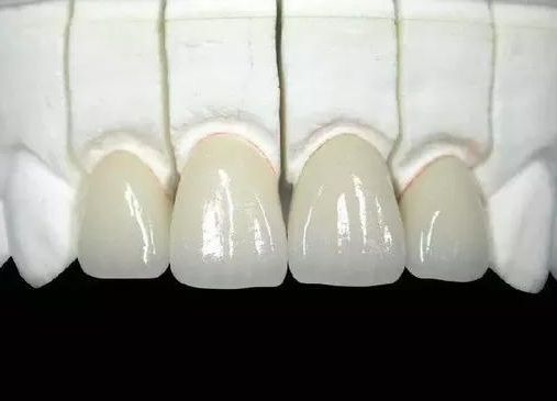 北京有哪些醫(yī)院割雙眼好？推薦一家口碑好的醫(yī)院