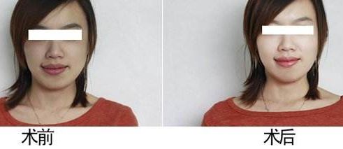 【河南晶塑祛痘】- 十大知名美容醫(yī)院綜合排名及口碑榜單