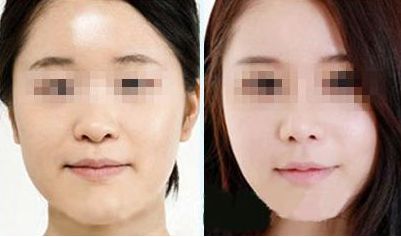 武漢治療痘印哪家醫(yī)院好？TOP10醫(yī)療整形機構排名揭曉！