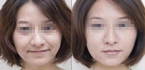 杭州動(dòng)態(tài)細(xì)紋美容醫(yī)院口碑排行榜揭秘：前10名深度評(píng)析！