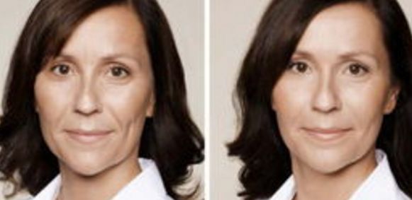 上海王艷鼻部修復：專業(yè)醫(yī)生解析失敗原因及修復方案