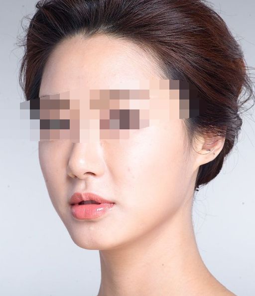 西安全身吸脂瘦身，十家整形醫(yī)院盤點！