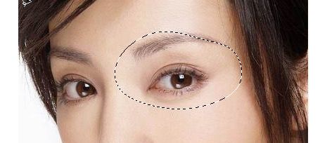 【醫(yī)院概況】北京侯俊杰醫(yī)生引領眼部整形潮流，真實過程圖分享！