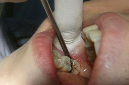 佛山鼻修復(fù)：10家排名靠前的醫(yī)院，勢頭強勁！專業(yè)高效，實力不可忽視