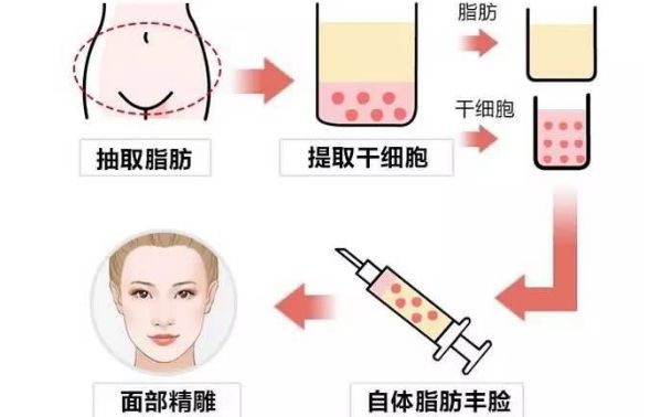 【鼻綜合】吳玉家醫(yī)生推薦│費(fèi)用介紹│坐診醫(yī)院及專家評價！