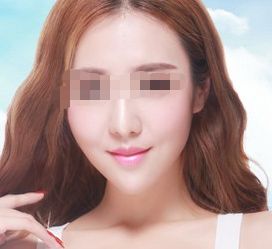 廣州哪家專業(yè)整形醫(yī)院鼻綜合治療好？皇佳貝麗提供舒適就診環(huán)境