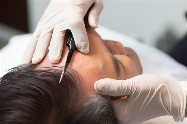 李國珍醫(yī)生鼻子整形效果如何？上海美麗之星醫(yī)院值得考慮！價(jià)格合理！