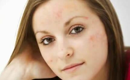 楊冪的鼻子到底是經(jīng)過(guò)整形嗎？探尋真相