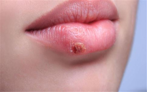 鄭州愛都滬美人吸脂好用嗎？吸脂效果如何？