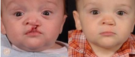 成都隆鼻醫(yī)院 - 震撼優(yōu)選排名榜，霸氣登頂！速戳看~