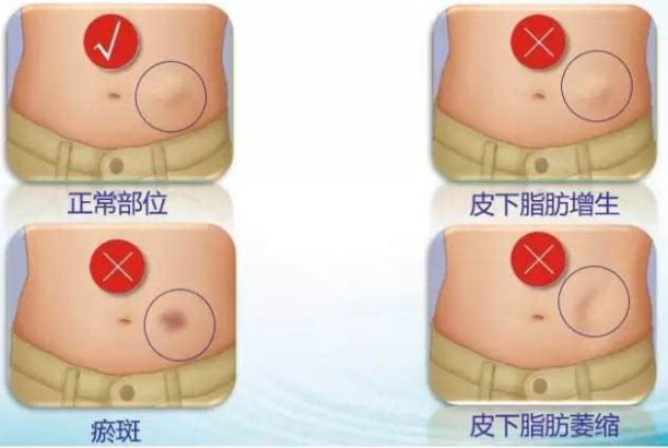 上海眉毛修復(fù)排行榜：十家醫(yī)療美容機(jī)構(gòu)綜合評比