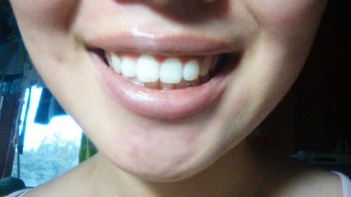 肇慶匯總靠前的整形醫(yī)院，哪家效果更好？2023整形價(jià)格一覽表