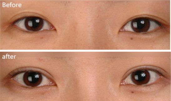 廣州祛雀斑醫(yī)院排行榜前十強(qiáng)，專家推薦！