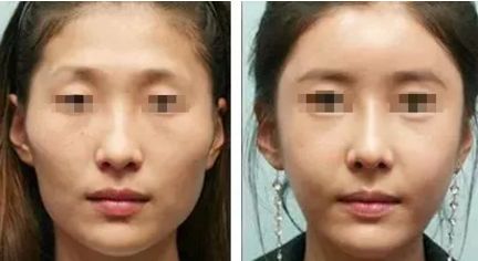 廣西嘴巴整形哪家醫(yī)院好？選前沿技術(shù)引領(lǐng)的醫(yī)療機(jī)構(gòu)，實(shí)測(cè)推薦最佳！