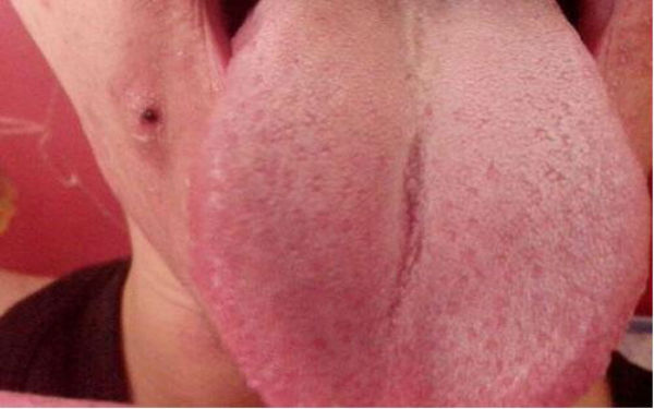 專業(yè)推薦！重慶耳朵畸形治療，這幾家醫(yī)院值得關(guān)注