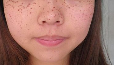 合肥三甲醫(yī)院美容科哪家好？探尋最受用戶歡迎的合肥三甲醫(yī)院美容科