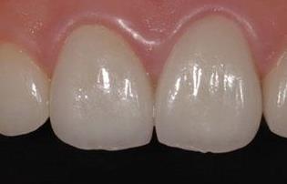 沈陽(yáng)雙眼皮整形醫(yī)院哪家技術(shù)審美比較好？TOP10名單揭曉！