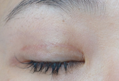 長沙下巴縮矯正醫(yī)院全球杰出名單揭曉！2023長沙下巴縮矯正整形醫(yī)院統(tǒng)治排行榜震撼發(fā)布！