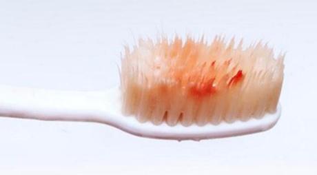 哪家南寧整形醫(yī)院更專業(yè)治療眼睛細紋微整形？2023南寧眼睛細紋微整形正規(guī)美容醫(yī)院排行榜同城精選！