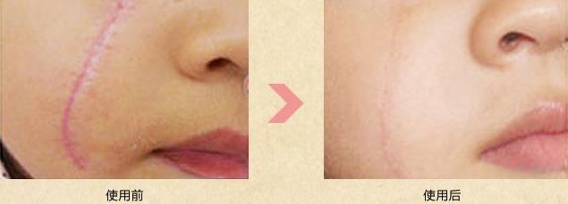 南陽割眼皮最好的醫(yī)院有哪些？