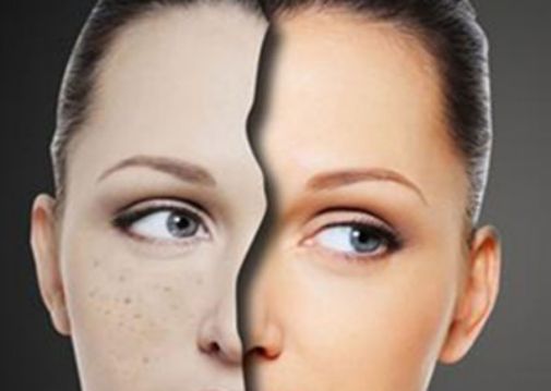 佟麗婭整容傳聞大揭秘！真相如何？