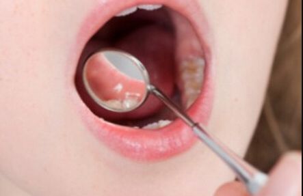 深圳祛痘印痘坑哪家醫(yī)院最靠譜？