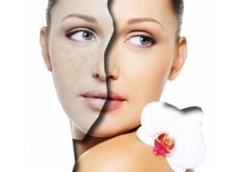 阜陽激光美容醫(yī)院哪家好？專家推薦阜陽激光祛痘效果最好的醫(yī)院